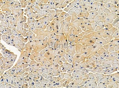 Dectin-1 Antibody - DF13249 at 1/100 staining mouse heart tissue by IHC-P.