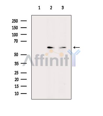 EBF2 Antibody - Western blot analysis of extracts from various samples, using EBF2 Antibody.