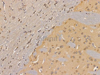 Loricrin Antibody - DF13441 at 1/100 staining rat brain tissue by IHC-P.