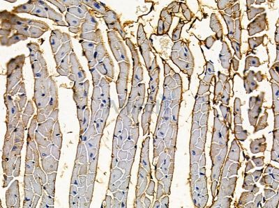 ATP6V1E1 Antibody - DF13510 at 1/100 staining mouse heart tissue by IHC-P.
