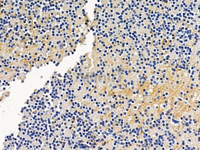 RASGRF2 Antibody - DF13513 at 1/100 staining mouse brain tissue by IHC-P.