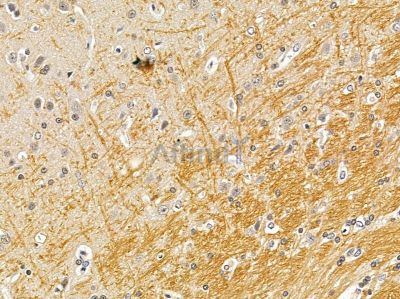 RASGRF2 Antibody - DF13513 at 1/100 staining rat brain tissue by IHC-P.