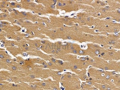 NAT14 Antibody - DF13526 at 1/100 staining rat brain tissue by IHC-P.