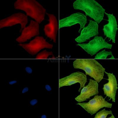 COQ10B Antibody - DF13998 staining A549 cells by IF/ICC.