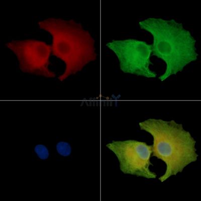 CHRNB2 Antibody - DF14019 staining A549 cells by IF/ICC.