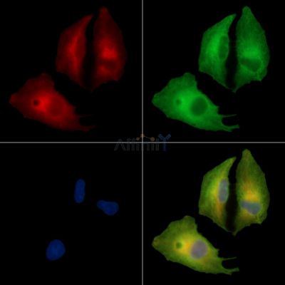 SLC38A4 Antibody - DF14025 staining A549 cells by IF/ICC.