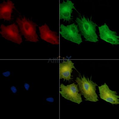 SLC25A38 Antibody - DF14037 staining A549 cells by IF/ICC.