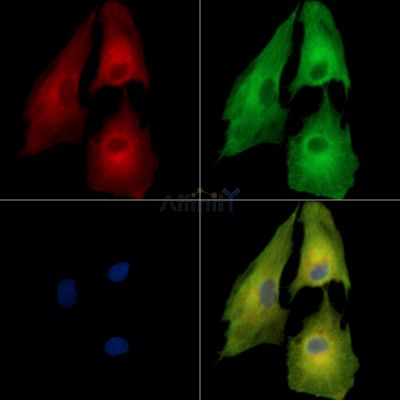 DLAT Antibody - DF14046 staining A549 cells by IF/ICC.
