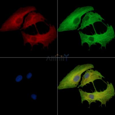 TMEM2 Antibody - DF14167 staining A549 cells by IF/ICC.