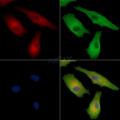 HAUS5 Antibody - DF14194 staining A549 cells by IF/ICC.