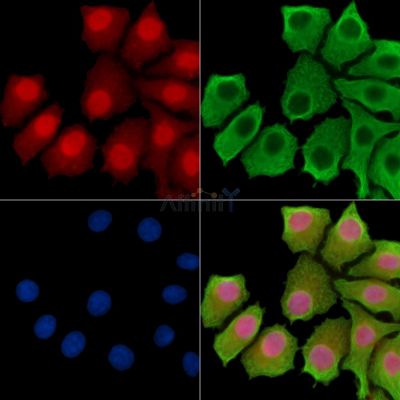 TP53INP2 Antibody - DF14312 staining HepG2 cells by IF/ICC.