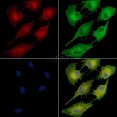 FAM83B Antibody - DF14340 staining A549 cells by IF/ICC.