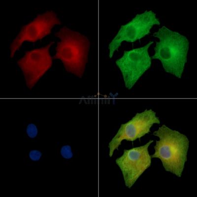 ChT1 Antibody - DF14348 staining A549 cells by IF/ICC.