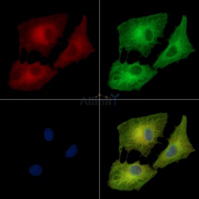 BRD9 Antibody - DF14352 staining A549 cells by IF/ICC.
