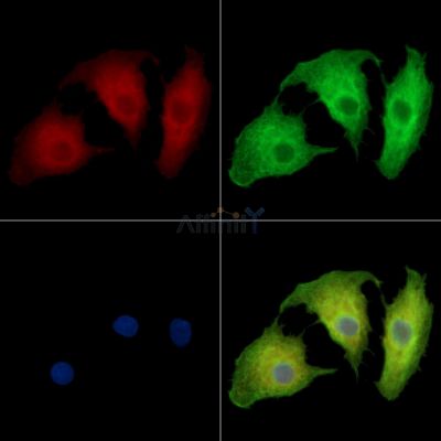 P311 Antibody - DF14359 staining A549 cells by IF/ICC.