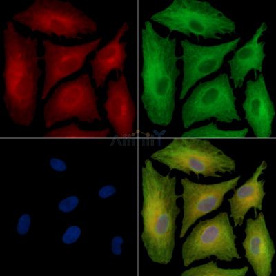 PPP1R11 Antibody - DF14365 staining A549 cells by IF/ICC.