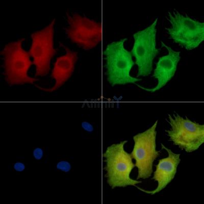 CLEC1B Antibody - DF14376 staining A549 cells by IF/ICC.