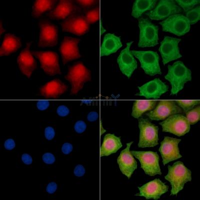 SRA1 Antibody - DF14421 staining HepG2 cells by IF/ICC.