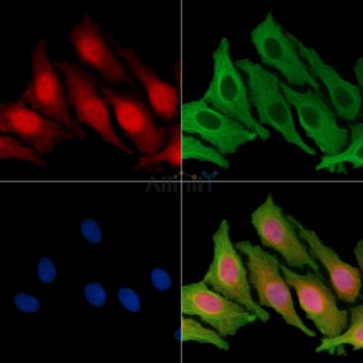 ZNF232 Antibody - DF14445 staining HepG2 cells by IF/ICC.