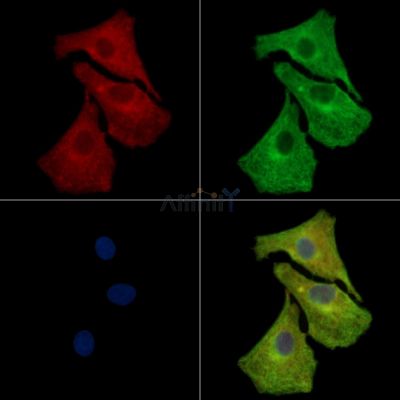 RAB3B Antibody - DF14446 staining A549 cells by IF/ICC.