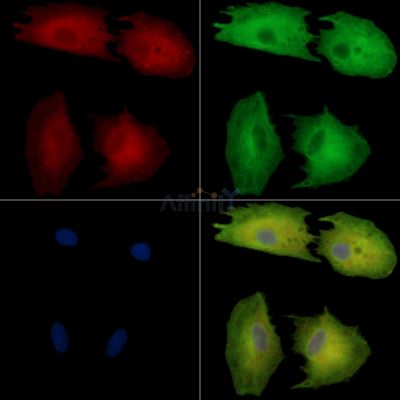 SYNGR1 Antibody - DF14470 staining A549 cells by IF/ICC.