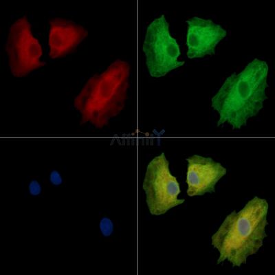PPME1 Antibody - DF14474 staining A549 cells by IF/ICC.