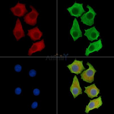 CADPS Antibody - DF14527 staining HepG2 cells by IF/ICC.