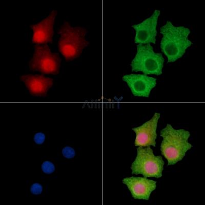 NCAPD2 Antibody - DF14535 staining HepG2 cells by IF/ICC.