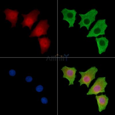 HMGB4 Antibody - DF14618 staining HepG2 cells by IF/ICC.