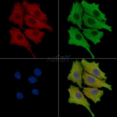 TFB1M Antibody - DF14634 staining HepG2 cells by IF/ICC.