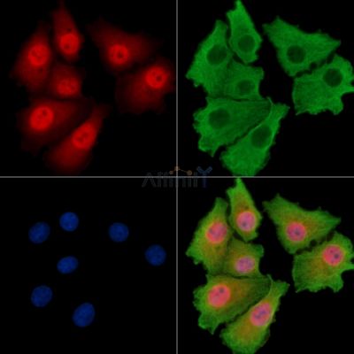 ARID5A Antibody - DF14720 staining HepG2 cells by IF/ICC.