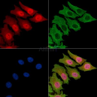 SLC39A11 Antibody - DF14747 staining HepG2 cells by IF/ICC.