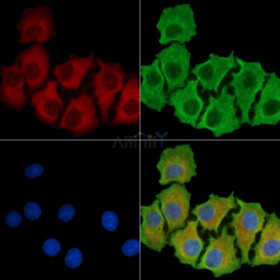 CFAP53 Antibody - DF14753 staining HepG2 cells by IF/ICC.
