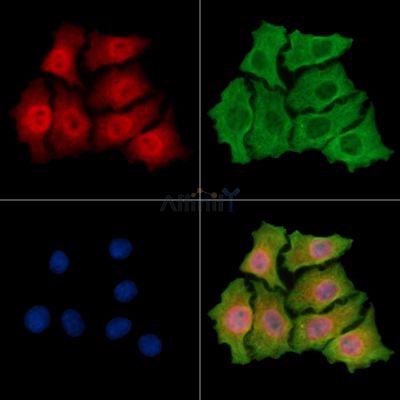 PHRF1 Antibody - DF14772 staining HepG2 cells by IF/ICC.
