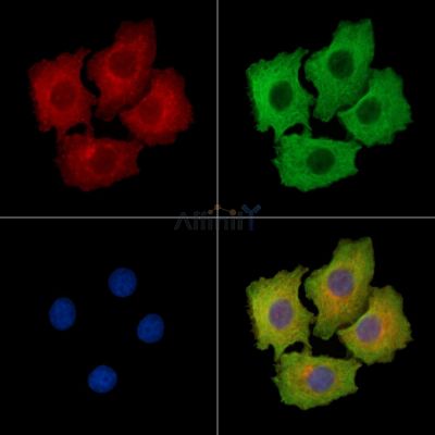 CCSER1 Antibody - DF14803 staining HepG2 cells by IF/ICC.