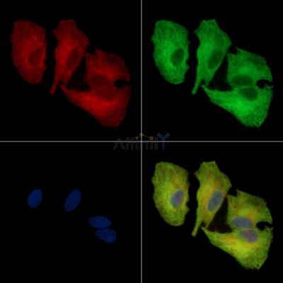 ACTL8 Antibody - DF14852 staining A549 cells by IF/ICC.