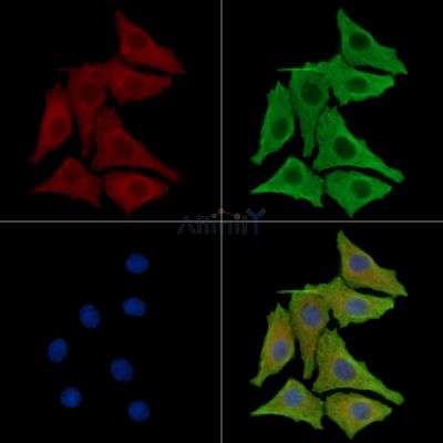 TMLHE Antibody - DF14872 staining HepG2 cells by IF/ICC.