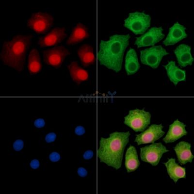 URB2 Antibody - DF15093 staining HepG2 cells by IF/ICC.