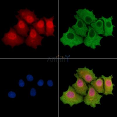 TRMT1L Antibody - DF15135 staining HepG2 cells by IF/ICC.