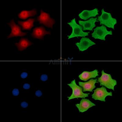 MCRIP1 Antibody - DF15306 staining HepG2 cells by IF/ICC.