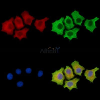 RABGAP1 Antibody - DF15335 staining HepG2 cells by IF/ICC.