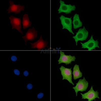 COMMD3 Antibody - DF15390 staining HepG2 cells by IF/ICC.