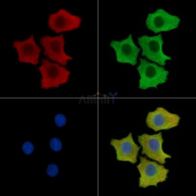 SGSM1 Antibody - DF15425 staining HepG2 cells by IF/ICC.
