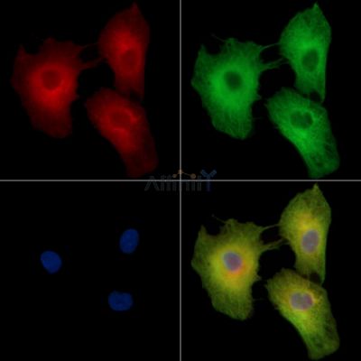 TREML2 Antibody - DF15746 staining A549 cells by IF/ICC.