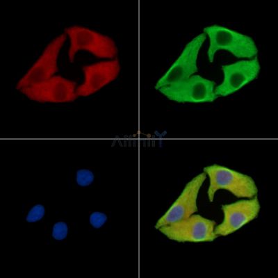 METTL21A Antibody - DF15919 staining Hela cells by IF/ICC.
