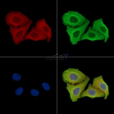 GAPVD1 Antibody - DF15933 staining Hela cells by IF/ICC.
