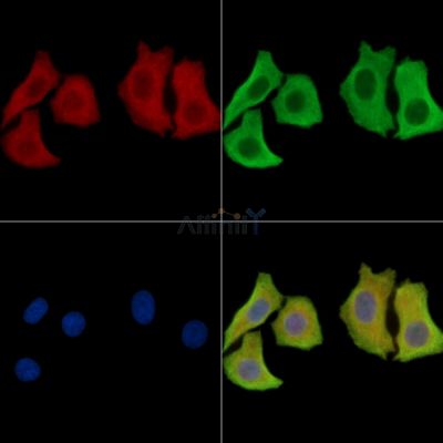 GCN1 Antibody - DF15941 staining Hela cells by IF/ICC.