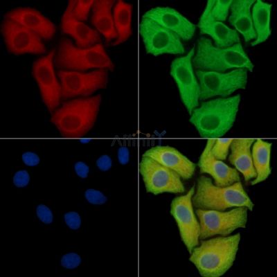 MPP7 Antibody - DF15967 staining Hela cells by IF/ICC.