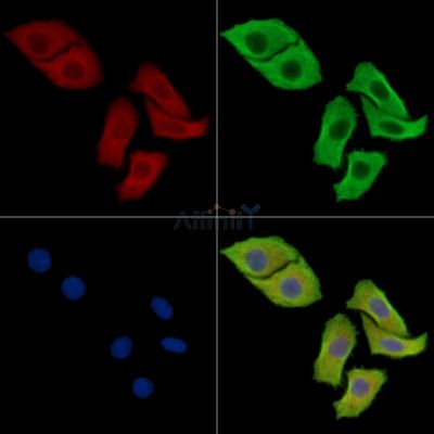 TMEM74 Antibody - DF15970 staining Hela cells by IF/ICC.