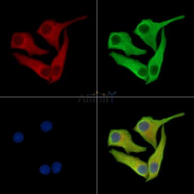 TPST2 Antibody - DF15973 staining Hela cells by IF/ICC.